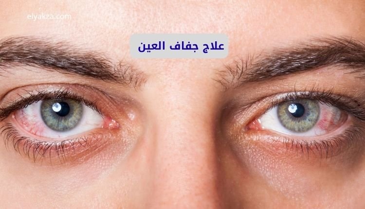 علاج جفاف العين