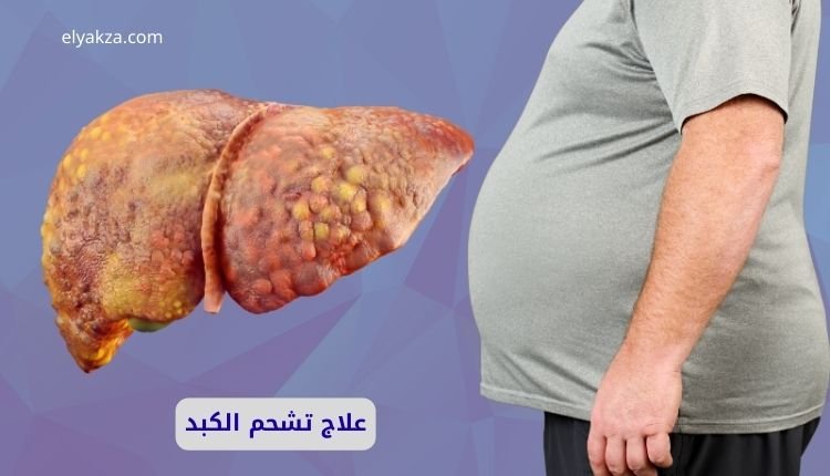 علاج تشحم الكبد