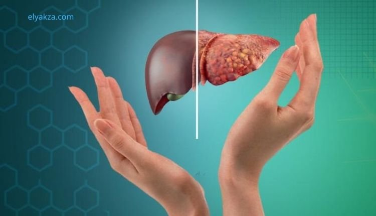 علاج تشحم الكبد: دليلك الشامل للتخلص من الكبد الدهني طبيعياً ونهائياً 1 الكيتو والكربوهيدرات المعقدة وتشحم الكبد