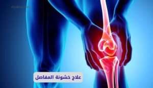 علاج خشونة المفاصل