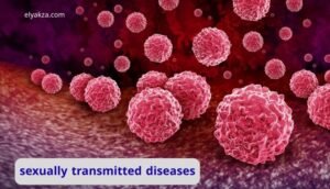 sexually transmitted diseases