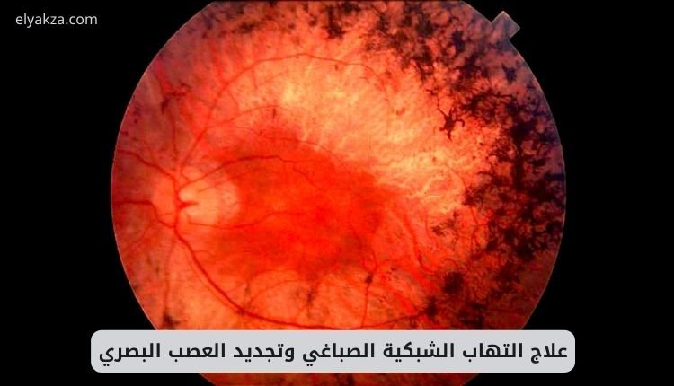 علاج التهاب الشبكية الصباغي وتجديد العصب البصري