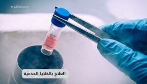 موقع اليقظة - الموقع العربي الشامل 9 العلاج بالخلايا الجذعية