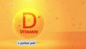 نقص فيتامين د