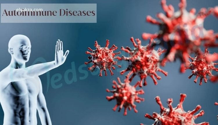 Nobel Prize 2025 Discovery on Autoimmune Diseases: A Breakthrough in Understanding and Healing 4 Autoimmune Diseases Are Not Always Chronic