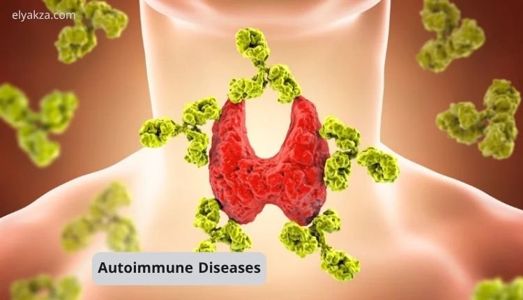 Nobel Prize 2025 Discovery on Autoimmune Diseases: A Breakthrough in Understanding and Healing 4 Autoimmune Diseases