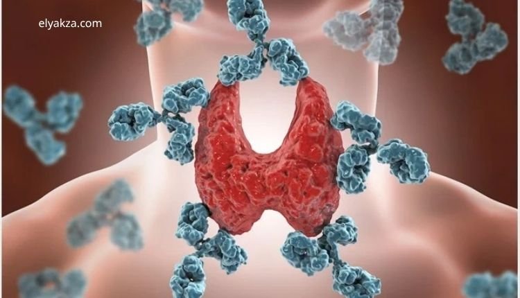 Nobel Prize 2025 Discovery on Autoimmune Diseases: A Breakthrough in Understanding and Healing 3 The Role of the FOXP3 Gene