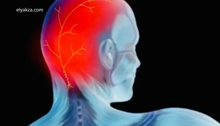 أعراض التهاب الأعصاب في الرأس، الدوخة وثقل الرأس، وكهرباء المخ عند الأطفال – د. أحمد الغيطي يوضح الأسباب والعلاج 3 الأسباب المحتملة لالتهاب الأعصاب في الرأس